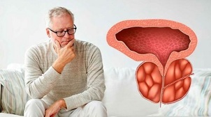 cauzele prostatitei bacteriene la bărbați
